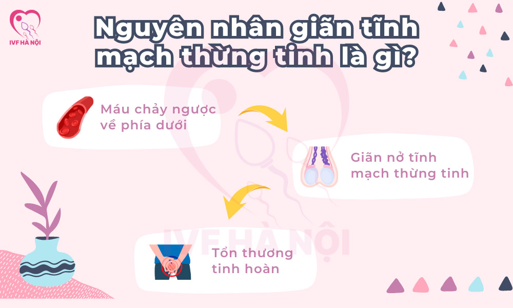 Nguyên nhân gây giãn tĩnh mạch thừng tinh là gì?